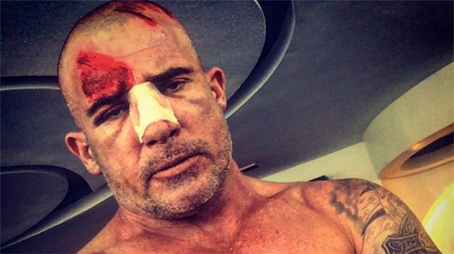 Dominic Purcell ferito gravemente sul set di Prison Break