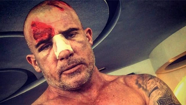 Dominic Purcell ferito gravemente sul set di Prison Break